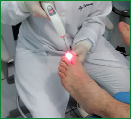 Laserterapia