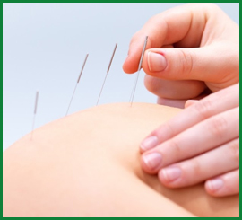 Acupuntura