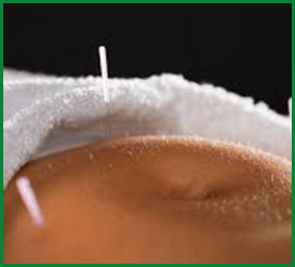 Acupuntura Lipolítica