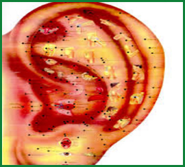 Auriculoterapia